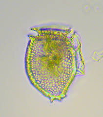 Image result for Amnesic Shellfish Poisoning