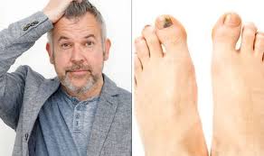 Image result for toe black diabetes