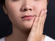 Image result for jaw dislocation when yawning treatment
