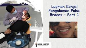 Kami menitik beratkan pada bidang konservasi dan estetika gigi, estetika gigi tidak dapat lepas dari merapikan gigi (kawat gigi). Luqman Kongsi Pengalaman Pakai Braces Part 1