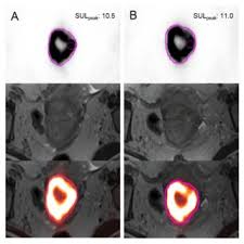 Maybe you would like to learn more about one of these? Pet Ct Vs Pet Mr Images From A Same Patient 4 Pet Ct Imaging At Download Scientific Diagram