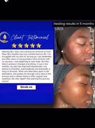 💍Healthy skin is the best accessory a bride can wear, My heart is so full  re-reading @ginab.xo kind words as we prepared for her upcoming wedding  over this past year. , Together, we turned frustration ...