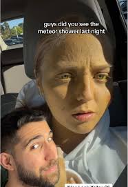 Amber and Arlo Jaundice