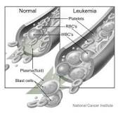 Image result