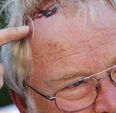 Sie waren seit juni getrennt. Amoklauf Lorrach Die Kinderliebe Mutter Die Ihren Sohn Erschlug Welt