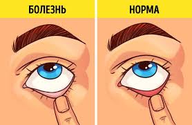 9 Prostejshih Medicinskih Testov Kotorye Vy Mozhete Vypolnit Pryamo Sejchas Medical Tests Medical Peripheral Artery Disease