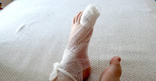 Image result for Akutní zánět nehtového lůžka