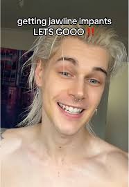 Jawline Transformation Techniques Explained