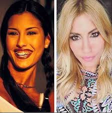 Cagla Sikel Estetiksiz Hali En Magazin