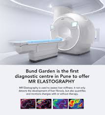 Best Diagnostic Centres In Pune Mri Scan Ct Scan Radiology Star Imaging
