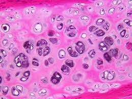 Connective Tissue Hyaline Cartilage Histology Slides Human Anatomy And Physiology
