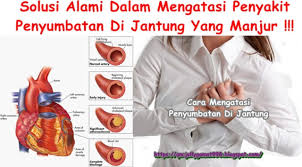 Mengonsumsi makanan sehat bisa mengurangi risiko terkena penyakit jantung. Cara Mengatasi Penyumbatan Di Jantung Kumparan Com