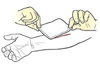 Sloppy or rushed characters leave a large amount of bandage dangling. First Aid Bandaging Saint Luke S Health System