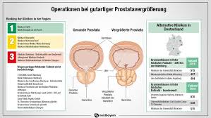Explains prostate problems including prostatitis and benign prostatic hyperplasia. Prostata Probleme Wenn Manner Standig Zur Toilette Mussen Nurnberg Furth Erlangen Nordbayern De