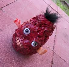 Image result for teratoma