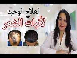 المينوكسيديل العلاج الوحيد لانبات الشعر والصلع وفراغات الذقن سر نجاح استخدامه وما لاتعرفه عنه youtube minoxidil hair treatment hair beauty