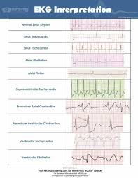 Ekg Strip Interpretation Nurse Ekg Interpretation Nursing School