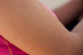 Why do humans get "goosebumps" when they are cold, or under other circumstances? | Scientific American