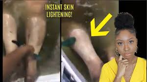Find many great new & used options and get the best deals for 2 x genuine jolen creme bleach lightens dark facial hair cream skin fairness 18g at the best online prices at ebay! Instant Skin Bleaching Peel For Dark Skin Why I Bleached My Skin Youtube