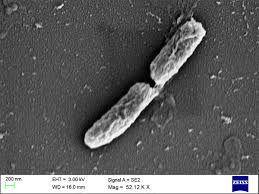 Image result for Shigella