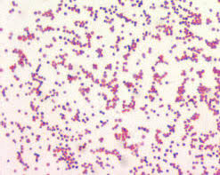 Francisella tularensis is a highly infectious agent but its virulence factors have not been well characterized. Nursing Ce Rnceus Com