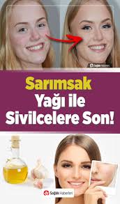 Sarimsak Yagi Neye Iyi Gelir Sarimsak Yaginin Faydalari Nelerdir Sifali Bitkiler Sarimsak Dogal Cilt Bakimi Cilt Bakimi