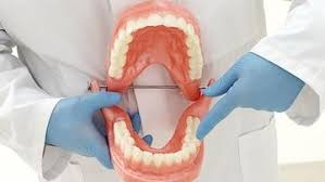 Additionally, you may have sustained discomfort along your jaw, ear, neck, or gums before you see or feel a tooth. Drs Smith And Domingue Blog What Are The Signs I Need My Wisdom Teeth Out