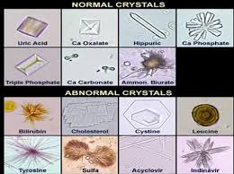 Urine Crystals Forms Medical Laboratories Medical Laboratory Scientist Clinical Chemistry Medical Technology
