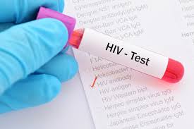 Phase 2 of gradual lifting of restrictions in qatar. Different Types Of Hiv Tests Al Borg Medical Laboratories Qatar