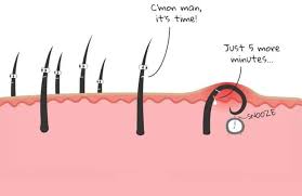 In some cases, the hair can be seen growing under the surface of the skin. How To Get Rid Of Ingrown Facial Hair Causes Prevention And Removal Beardoholic