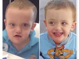 Steps Towards a Cure