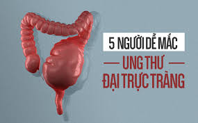 Chính vì thế, việc bổ sung một số kiến thức về hai căn bệnh này sẽ giúp bạn đọc không còn bị nhầm lẫn. 5 Nhom NgÆ°á»i Dá»… Bá»‹ Ung ThÆ° Ä'áº¡i Trá»±c Trang Antican Vn