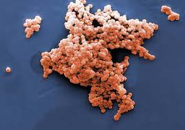 Image result for Group B Streptococcus