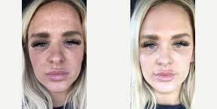 The Breazeale Clinic