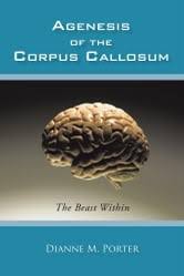 Agenesis of the Corpus Callosum eBook by Dianne M. Porter