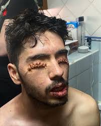 el primer adelanto de los varios maquillajes que hicimos para  @onirica_shortfilm de @dvs.films 😵😵😵 modelado prótesis @sgamezfx copias  y aplicación @sgamezfx y @blackbird__fx destacar lo que aguanto  @briandeparla sin ver durante dos