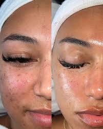 Bianca Webster, L.E., L.C.🫧 (@b_isforbeauty__) · Minneapolis, MN