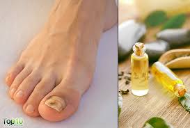Check out our vicks vapor rub selection for the very best in unique or custom, handmade pieces from our salves & balms shops. 10 Remedies To Fight Toenail Fungus At Home Top 10 Home Remedies