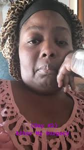 My Recovery has Definitely had it's Up, & Down moments. But, I am so Happy  Dr. Dallas was the Dr. to do my Surgery!