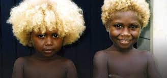 Pay a visit to melanesia's solomon islands, 1800 kilometers northeast of australia, and you'll notice a striking contrast: Black People With Natural Blonde Hair Everything Is Possible In Genetics Thasso