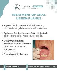 Image result for lichen planus on tongue)