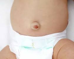 These can help reduce the inflammation and pain of the intestines, ensure that they are healthy and regulate bowel movements properly and reduce intestinal swelling. Can You Heal An Umbilical Hernia Without Surgery Times Panda