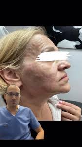 kalon Dermatology (@kalondermatology) • Instagram photos and videos