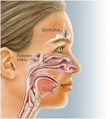 Auch die inhalation von gasen wie formalin oder ammoniak können nasenbluten verursachen. Postnasal Drip Syndrom Ursachen Symptome Behandlung Medlexi De