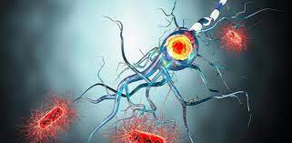 Causas inciertas de la esclerosis múltiple. Que Es La Esclerosis Multiple Sintomas Causas Y Como Tratar La Enfermedad