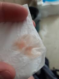 It could occur every cycle, a few times, or not at all. Tmi Pic Ovulation Bleeding Trying To Conceive Forums What To Expect