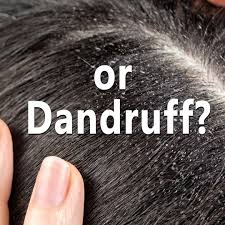 Image result for lice vs dandruff