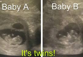Here i've shared the conception stories for my children. Clomid Twins Stories