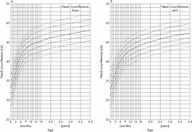 Organized Turner Syndrome Growth Chart Pdf Turners Syndrome