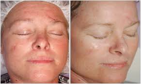 Trish — VILLANI MEDICAL